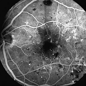 Magnified Specimen